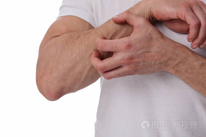 在白色背景上抓痒的人敏感皮肤过敏反应刺激