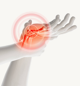 腕关节图片