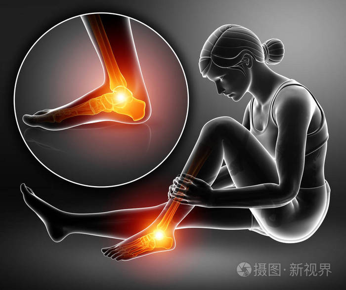 女性的脚和踝关节疼痛