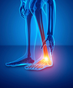 男脚和踝关节疼痛图片