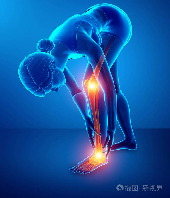 在腿部疼痛