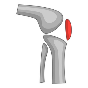 膝关节置换术植入卡通风格的图标