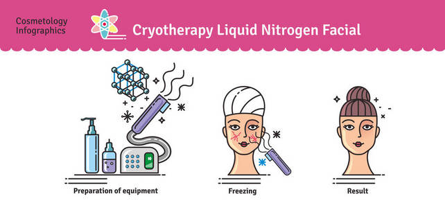 矢量插图集美容冷冻治疗