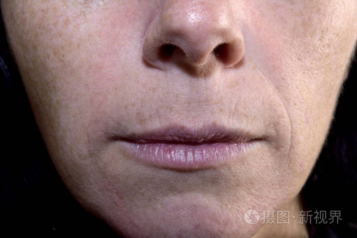 一名中年妇女皱巴巴的嘴唇细节4045岁