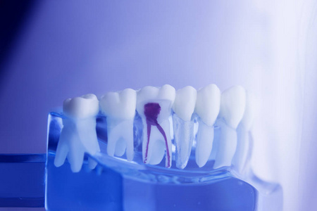 牙科牙齿牙科模型图片