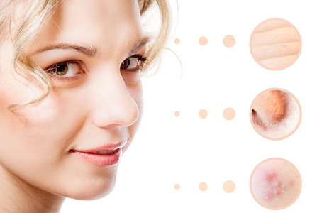 女人脸上的皮肤问题照片