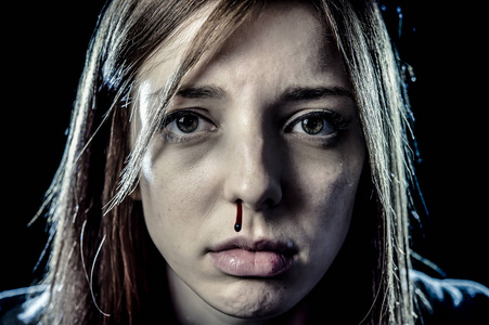 鼻子流血女事主的严重的虐待攻击的鼻子流血的脸照片