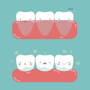 漂亮的牙齿的牙的牙龈手术插画