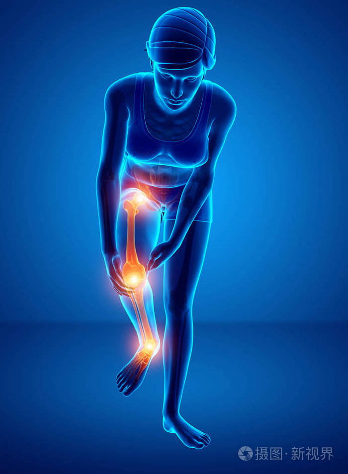 女性的腿部关节疼痛