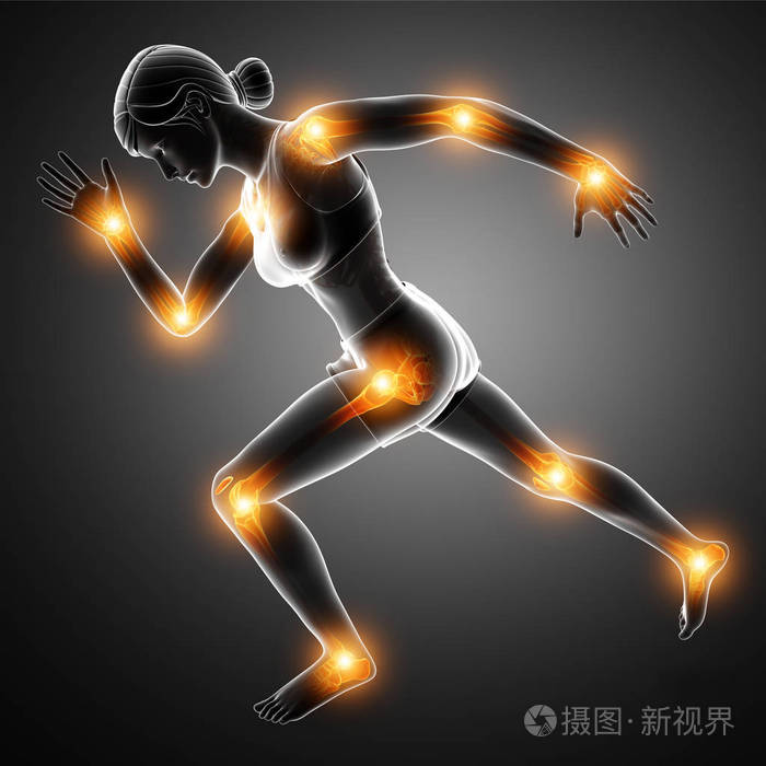 女性的关节疼痛