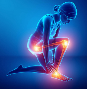 在腿部疼痛图片