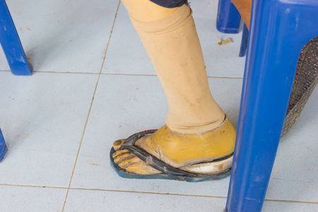 假肢膝关节图片