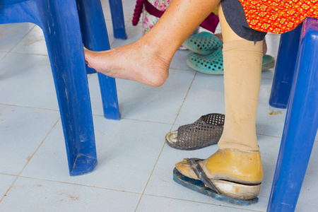 特写亚洲老女人用木制假肢照片