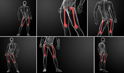 股骨上段三维渲染图