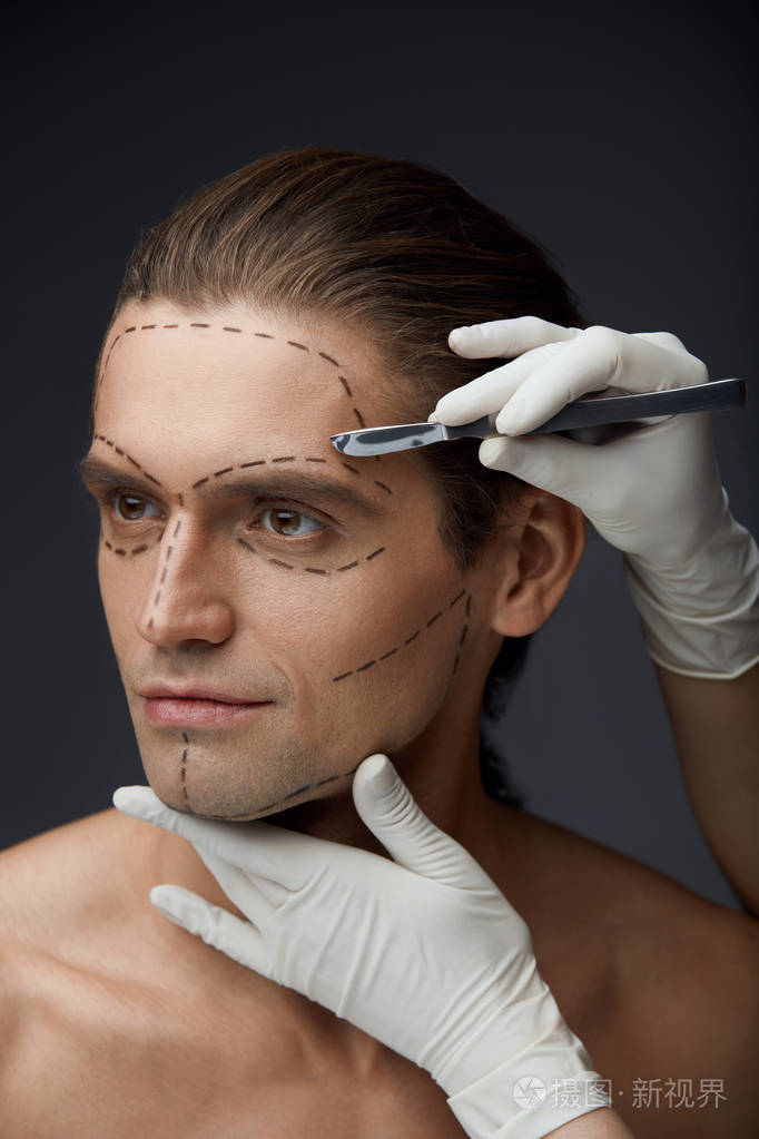 整形外科手术前脸上的黑色线条的男人