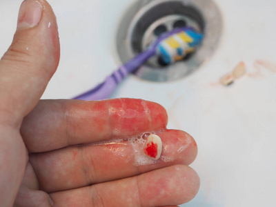 刷牙洗脸在洗脸盆里用血淋淋的刷子刷牙.牙科概念照片