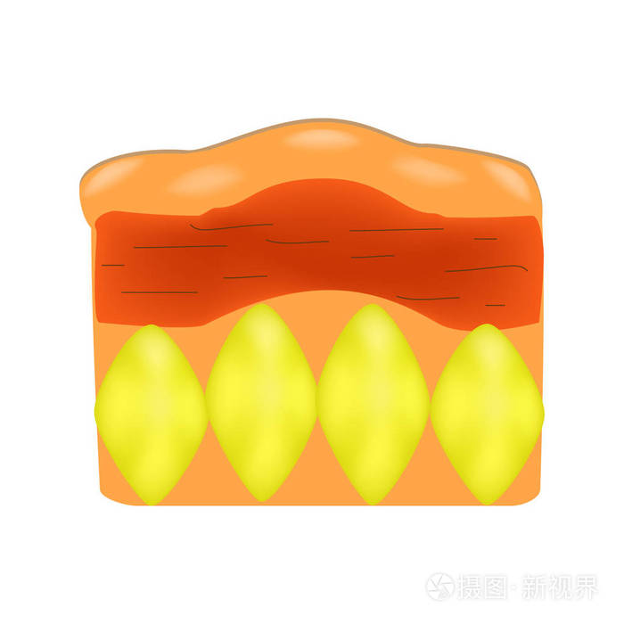 在人的皮肤老化 蜂窝组织炎 信息图表 对孤立背景矢量图插画 正版商用图片0y39jp 摄图新视界