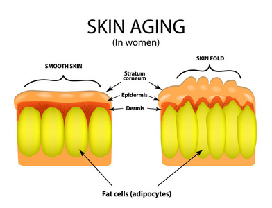 在妇女的皮肤老化。信息图表。对孤立背景矢量图