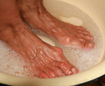 足浴治疗。修脚。卫生的医疗程序。洗脚