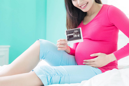 女子手持超声照片