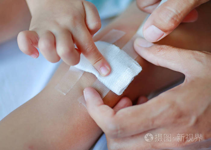 关闭在儿童的膝盖上的伤口.妈妈敷料儿童膝盖