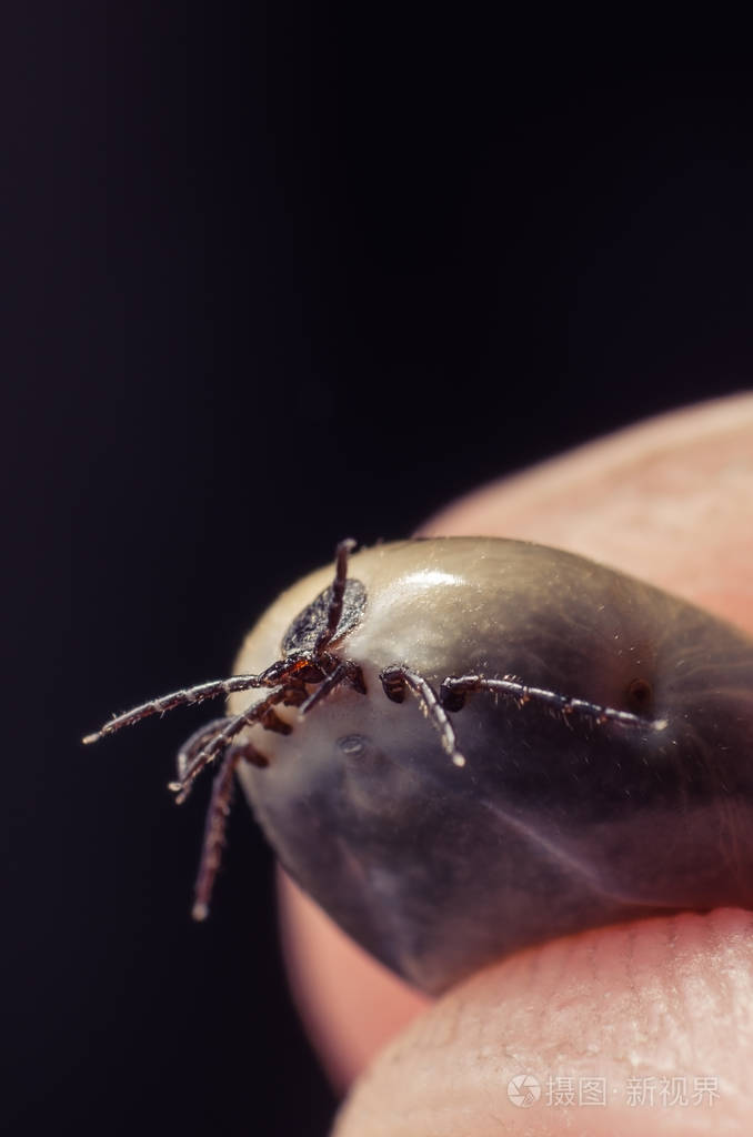 满腔热血坐在人体皮肤上的蜱虫