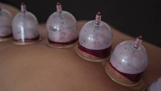 拔罐毛笔字图片