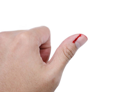 手指伤口图片-手指伤口素材-手指伤口插画-摄图新视界