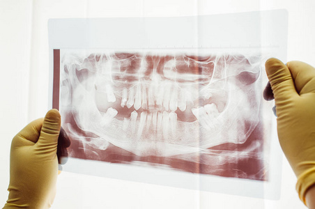 牙科突变特写的全景扫描
