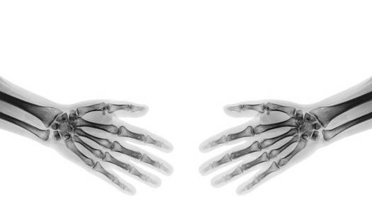 握了手。X 射线正常人类之手