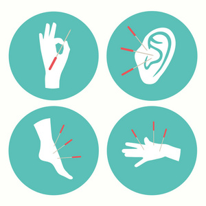 针灸图针灸保健治疗图标照片