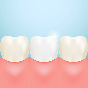 健康的牙齿，牙齿美白隔离在背景上。现实的矢量图