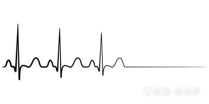 下载小样发票合同问题/举报骤向量概念死死亡心脏心电图心电心跳心