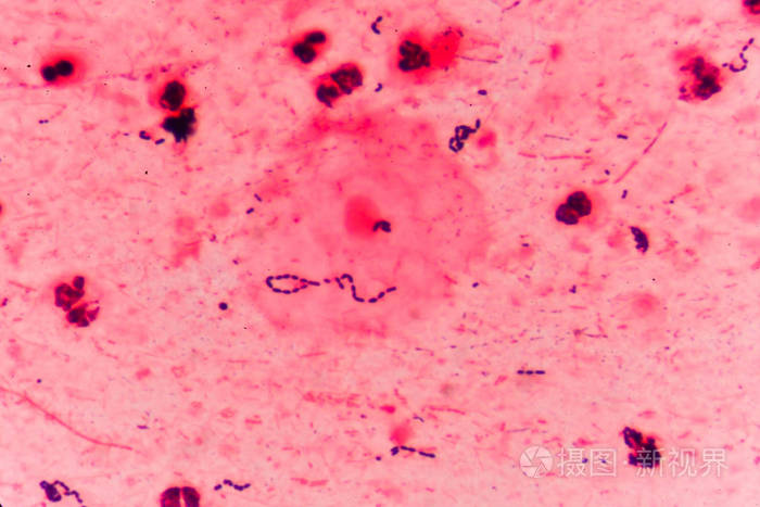 链球菌革兰氏染色图片