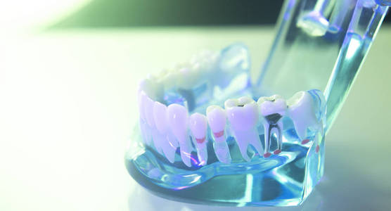 牙科牙齿牙医模型图片