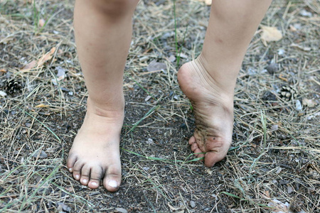 去除胖女人腿上脂肪的过程.没有脸,无法辨认的病人.