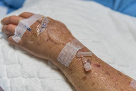 病人在医院用生理盐水静脉照片