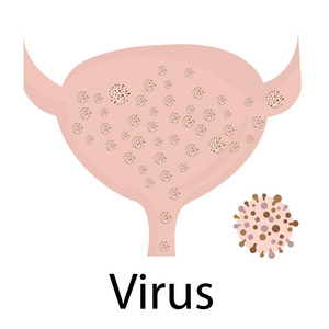 尿路感染。病毒