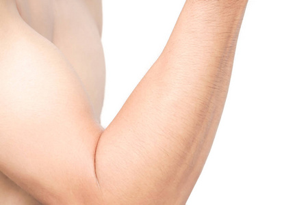 男人的手臂皮肤与白色背景 卫生保健和医疗的概念