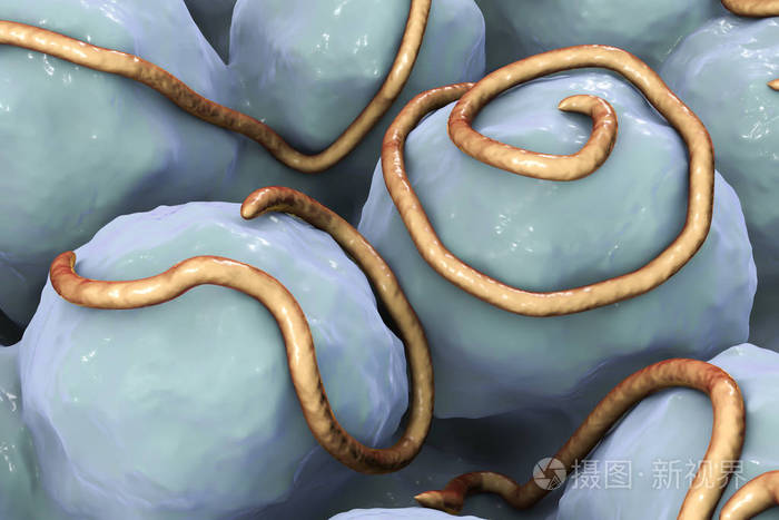 肠道寄生虫线虫蛲照片-正版商用图片0zgh2k-摄图新视界