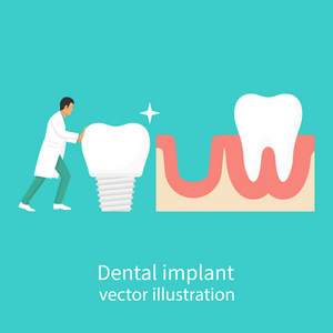 牙科植入物在手牙医