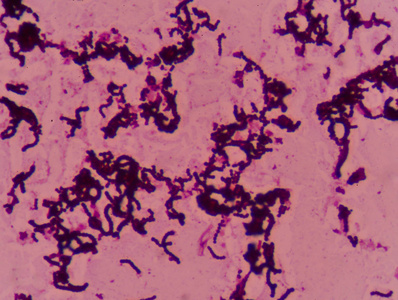 革兰氏阳性菌图片