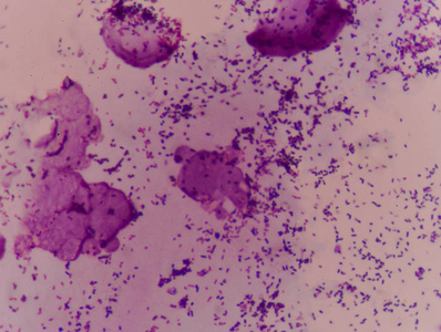 革兰氏染色试验显示细菌细胞