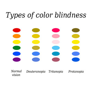 类型的色盲。眼睛颜色感知。对孤立背景矢量图