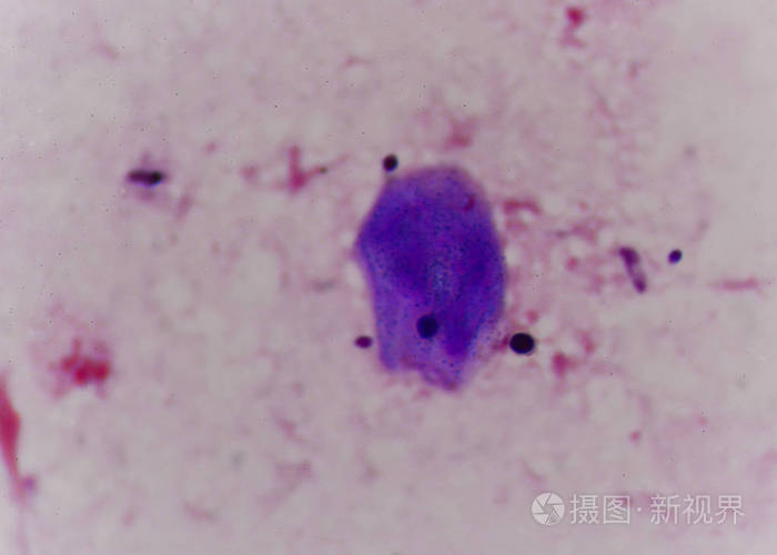 初露头角的酵母细胞中革兰染色方法照片 正版商用图片0zm3t7 摄图新视界