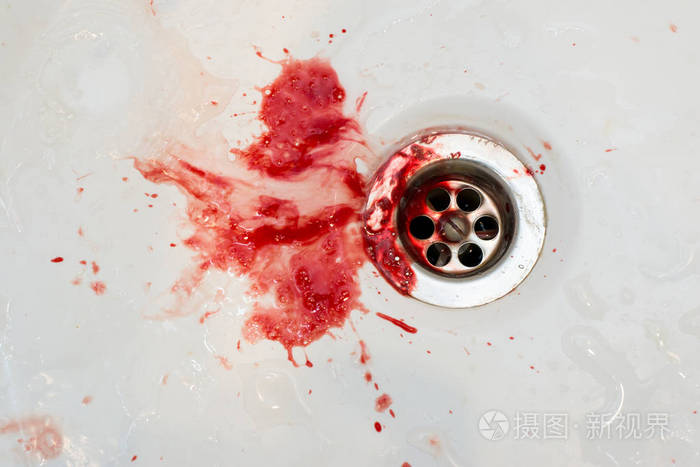 血液在水槽在牙医