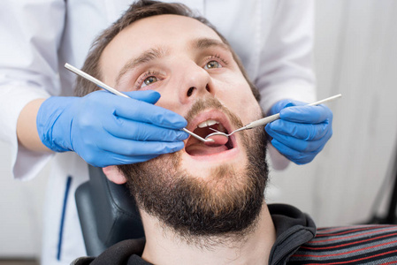 在牙科诊所里, 有胡子的人在牙科检查中关闭。牙医用牙科工具检查病人的牙齿镜子和探针。牙科