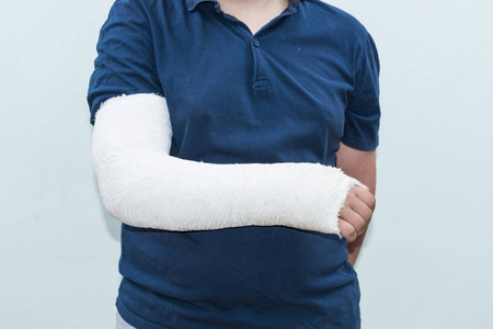 男孩用断胳膊,手臂上石膏作为治疗照片