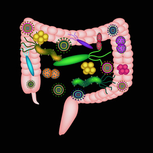 失调的肠道。大肠。dysbiosis 的结肠。细菌, 真菌, 病毒。信息.黑色背景上的矢量插图