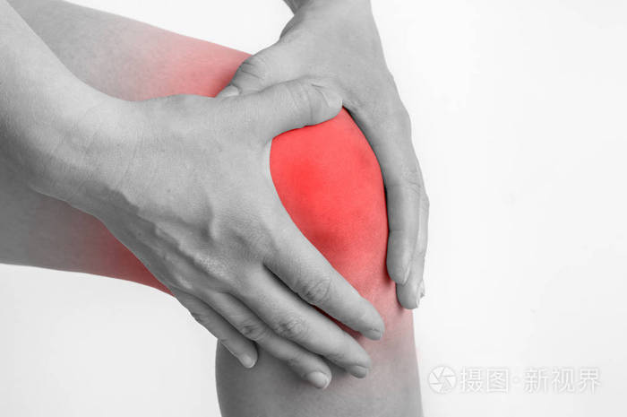 膝关节疼痛的女人抱着她酸痛的腿